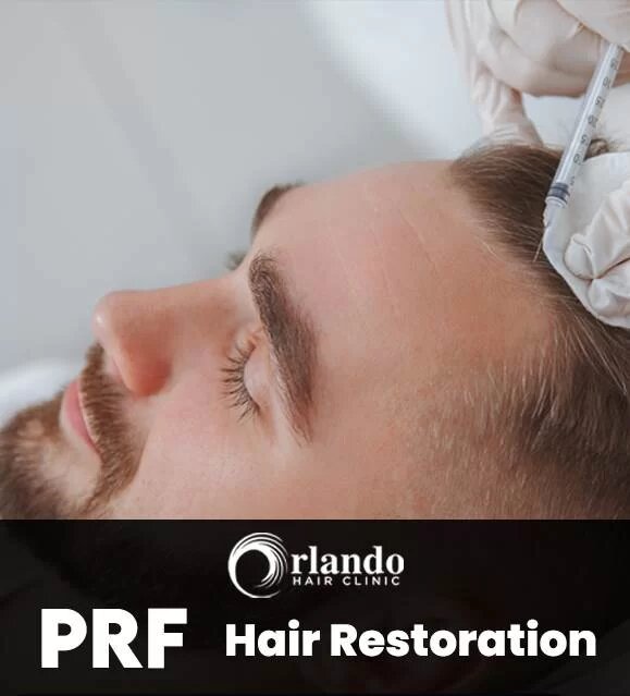 platelet rich fibrin hair restoration