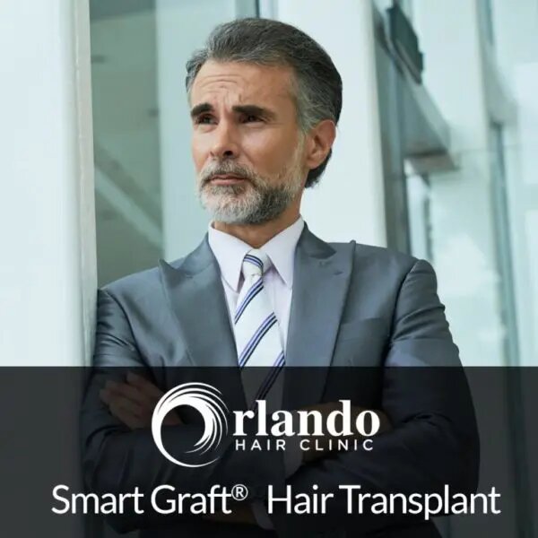 smartgraft hair transplant